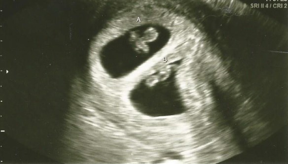 Week 7 A and B2_cropped